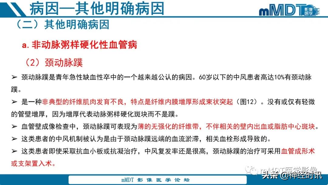 急性缺血性脑卒中ppt素材图片,青年缺血性脑卒中ppt