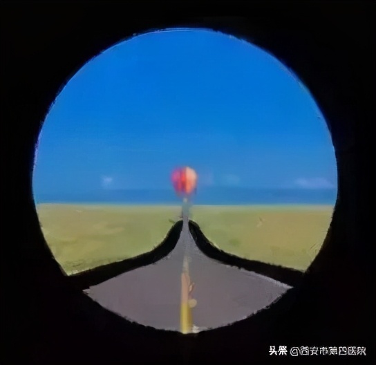 近视眼镜近处清楚远处模糊,近视看清楚近处较模糊