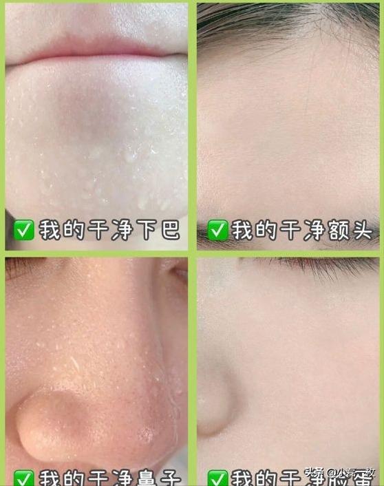 油皮皮肤怎么能变细腻光滑,油皮毛孔粗大适合什么粉底液