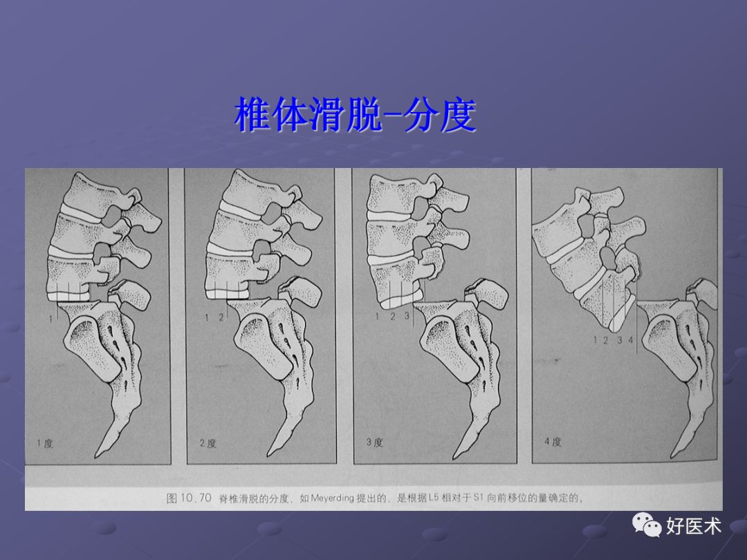 脊柱mri有哪些特点,乳腺疾病的mri诊断及鉴别
