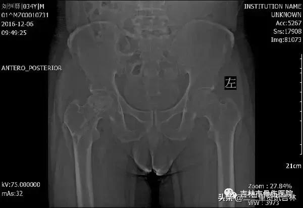 从医30余年，他治疗数以万计骨伤骨病患者