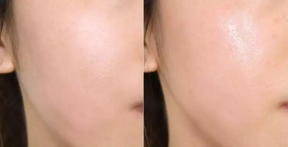 保湿补水套装旅行,适合长途出行的保湿护肤品