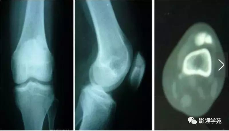 膝关节常见疼痛原因及其缓解方法,膝关节疼痛的16种最常见原因速查