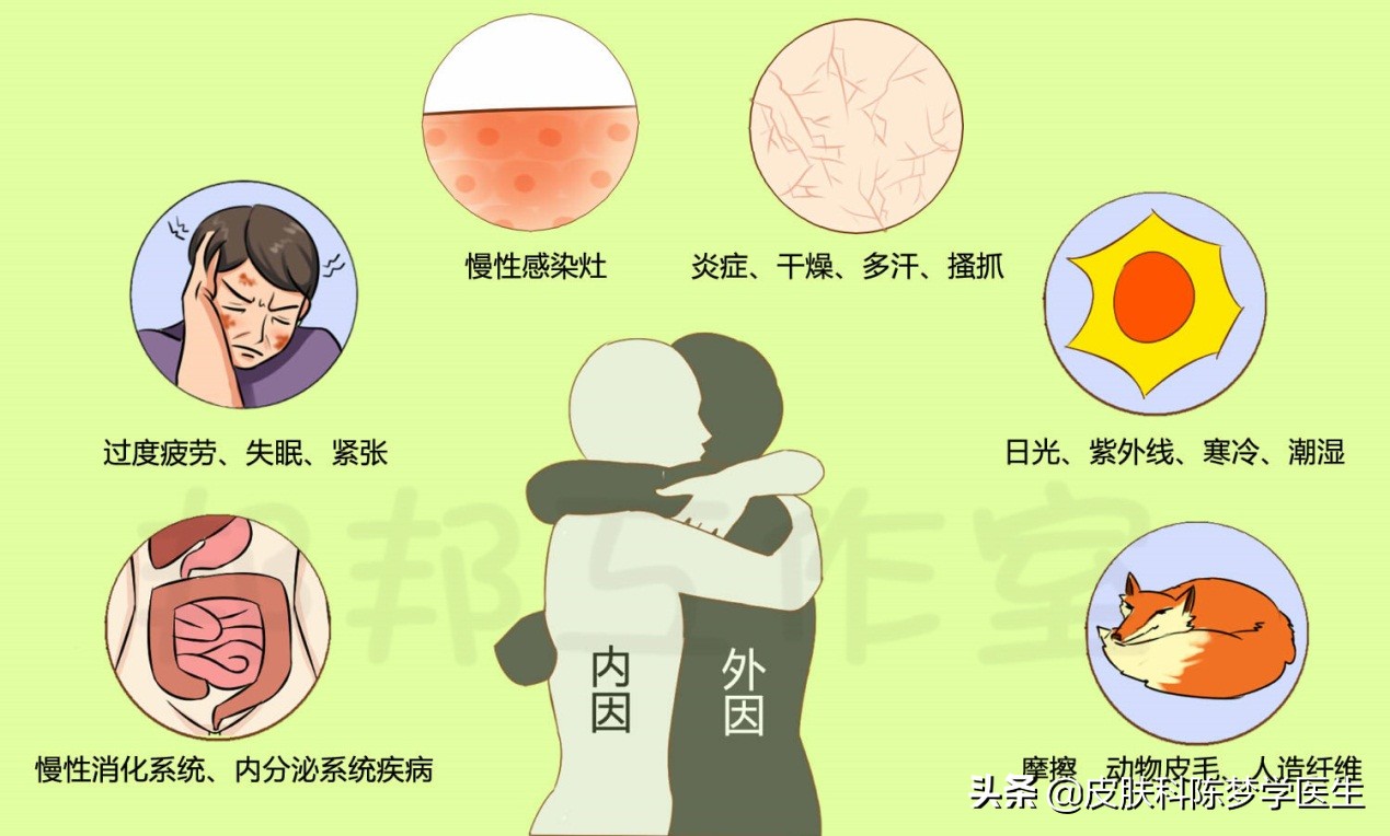 不同分期的湿疹怎么治疗,湿疹痒得钻心怎么办