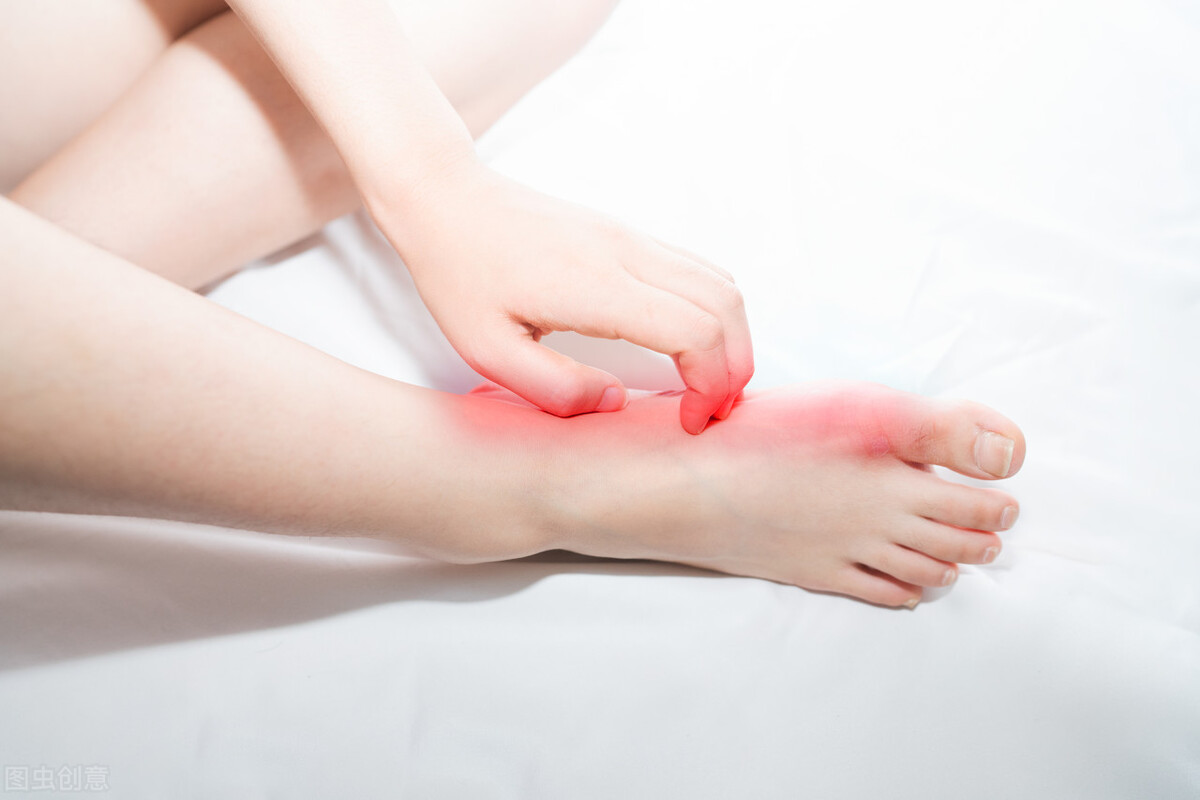 脚气瘙痒加脱皮,脚气瘙痒脱皮后跟角质干裂