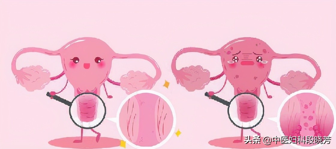 段晓芳医生看多囊怎样,段晓芳有多囊吗