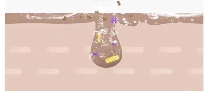 皮肤粗糙暗沉毛孔粗怎么改善,皮肤暗沉粗糙毛孔粗大