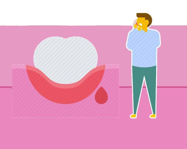 脂肪肝引起的黄疸怎么治疗,肥胖脂肪肝身上黑色素沉淀