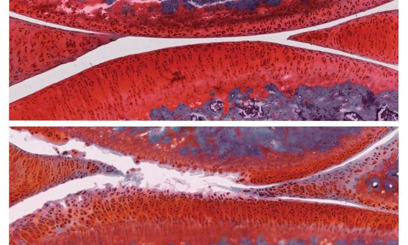 药物组合疗法可以做些什么,药物控制老年性关节炎