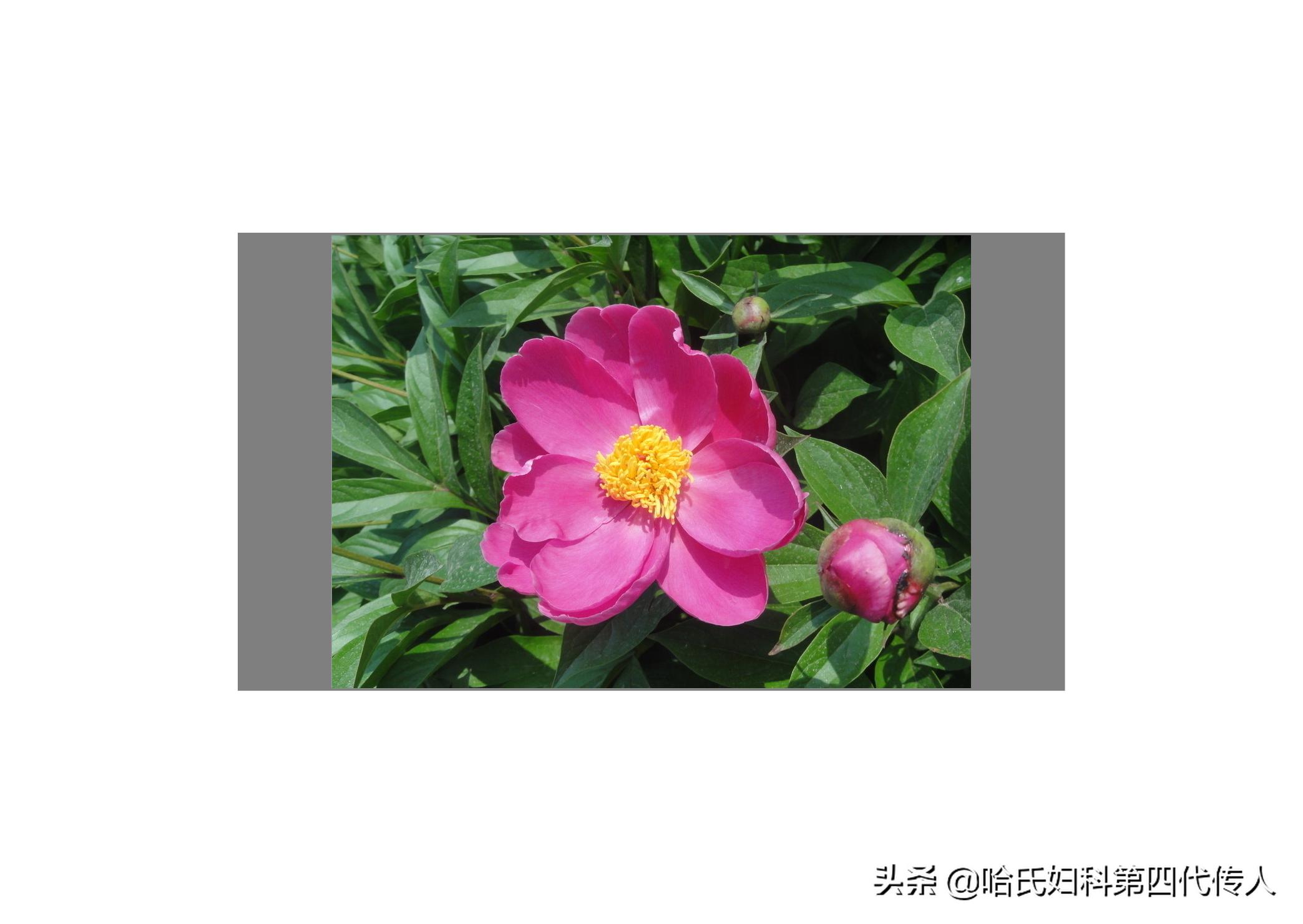 月经会不会突然消失,更年期月经慢慢消失还是突然就停