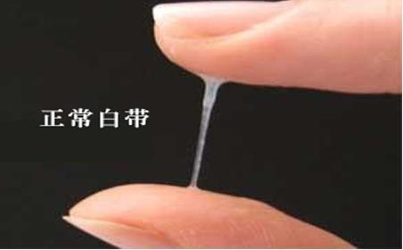 妇产科医生教你：从*裤内**看自己是否有妇科病