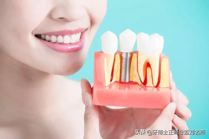 缺牙做修补和烤瓷哪个好,缺牙修复有几种方法