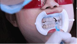 刷牙怎么刷能立刻从黄牙变成白牙,刷牙白牙小妙招