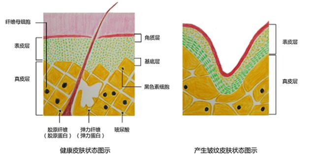 面部抗衰老有哪些项目,面部抗衰老有哪些整形项目