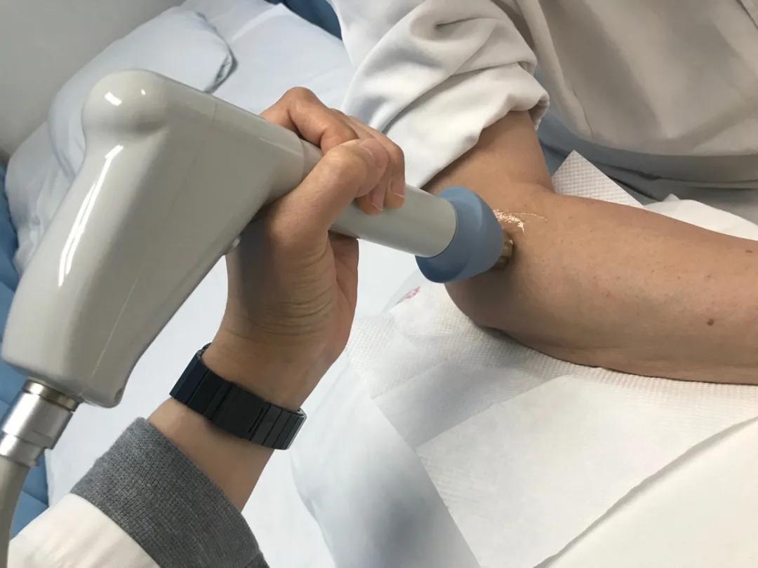 网球肘引起手臂疼痛用什么药治疗,有一种胳膊痛叫网球肘