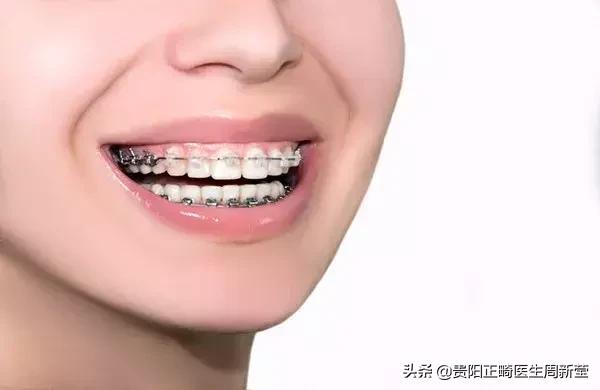 什么是“地包天”，地包天又该如何预防呢？