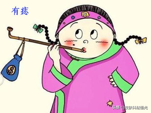 激光祛痣和药物祛痣哪个效果最好,激光和冷冻祛痣哪个更安全效果好