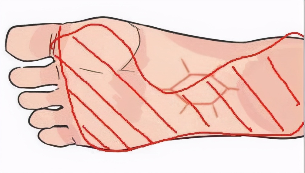 深蹲起来膝盖内扣是什么动作,相扑深蹲膝盖内扣