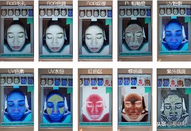 选择光电祛斑，出门再也不担心颜值掉线