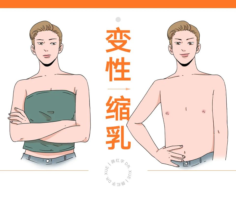 乳房缩小整形适合人群,乳房缩小术可能造成的并发症