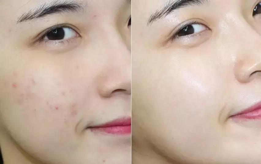 美丽新肌面膜,最全医美护肤面膜