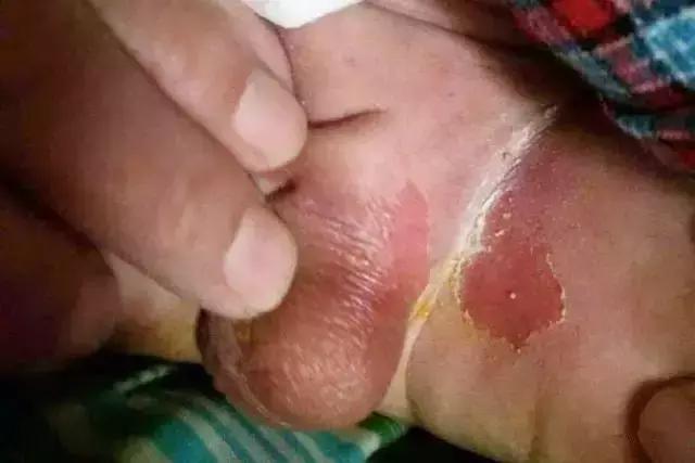 婴儿爽身粉孕妇可以用吗,婴儿爽身粉孕妈可以用吗