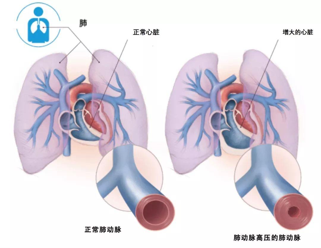 药店国产伟哥的正确服用方法,国产伟哥的优缺点和副作用
