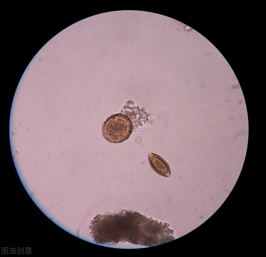 寄生虫病综合防治方法