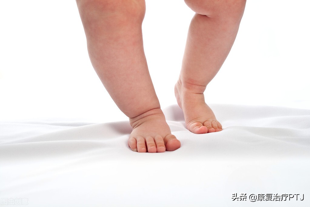 下肢力线异常的后果,下肢力线异常的临床表现