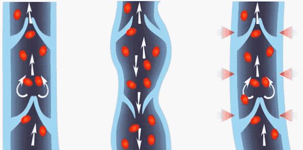 张蓝心瘦腿的方法,张蓝心的腿法图解
