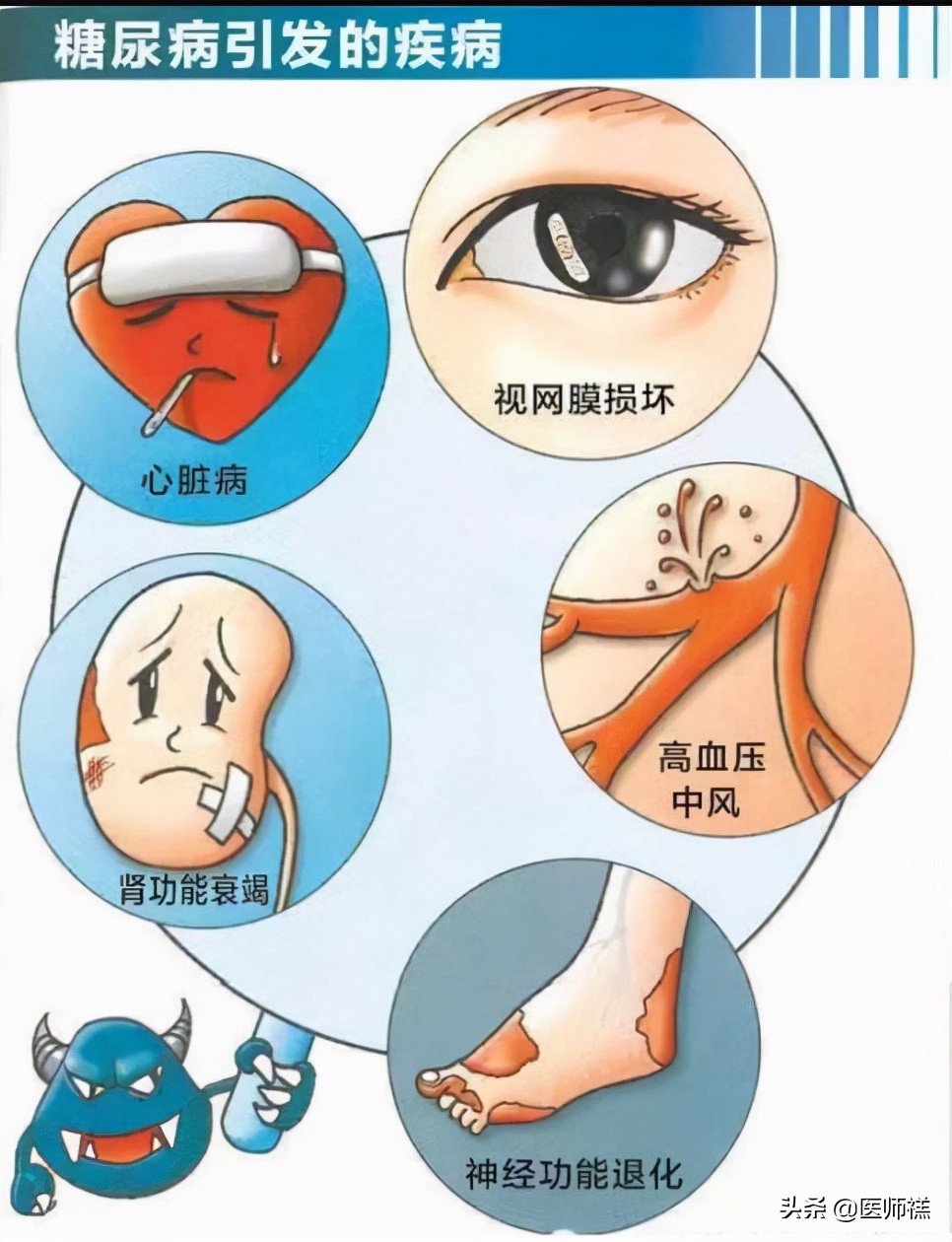 2型糖尿病用药指导注意事项,二型糖尿病用药指南