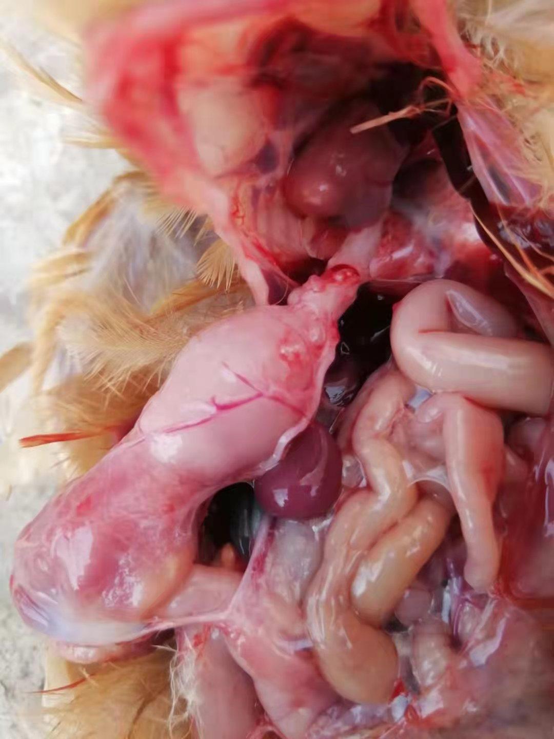 高发腺肌胃炎的症状,最常见慢性胃炎临床表现