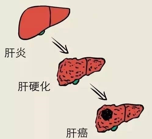 我替低水平病毒复制的乙肝患者担忧