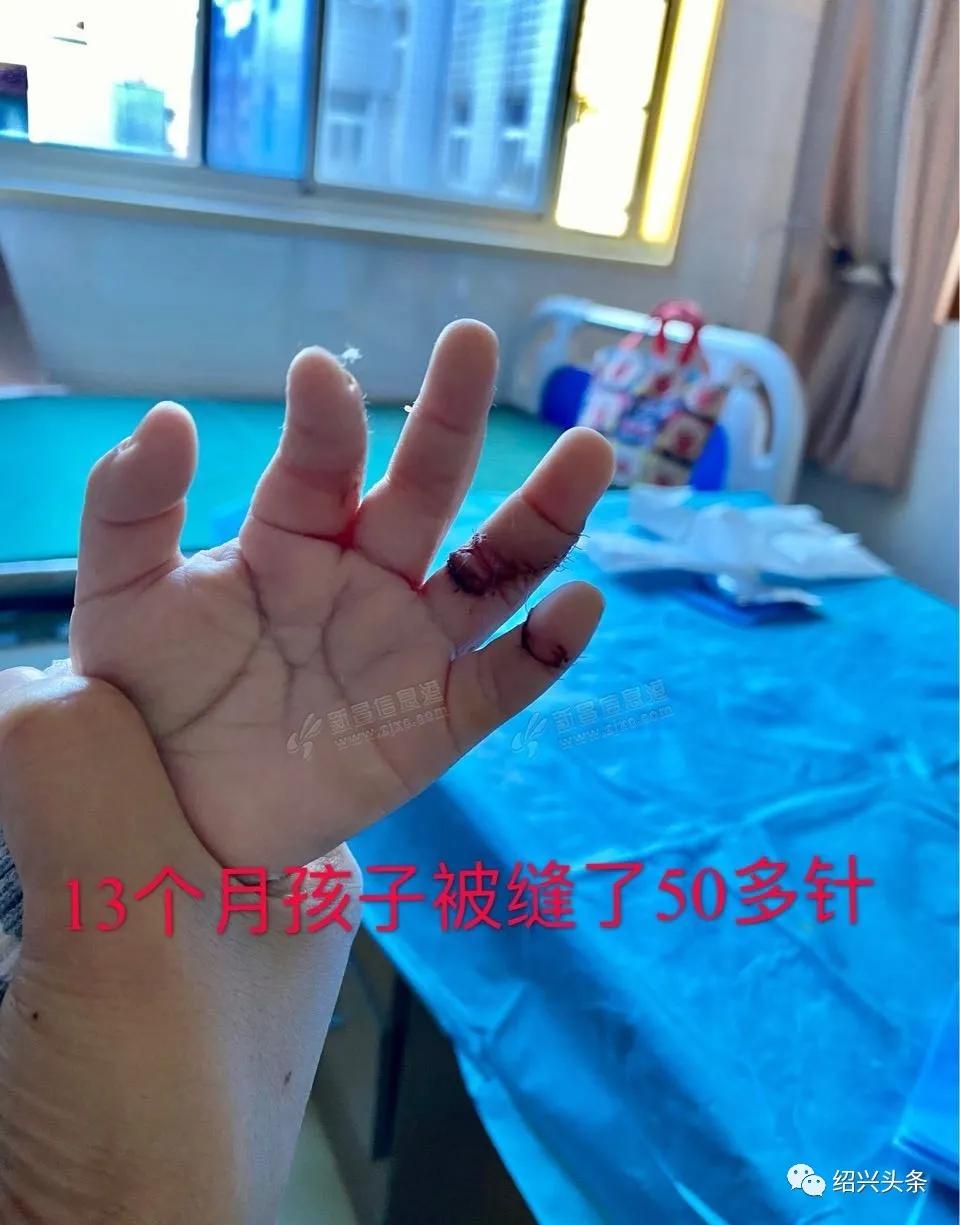 绍兴13个月宝宝在商场割断手指筋，现场血肉模糊，急送省儿保