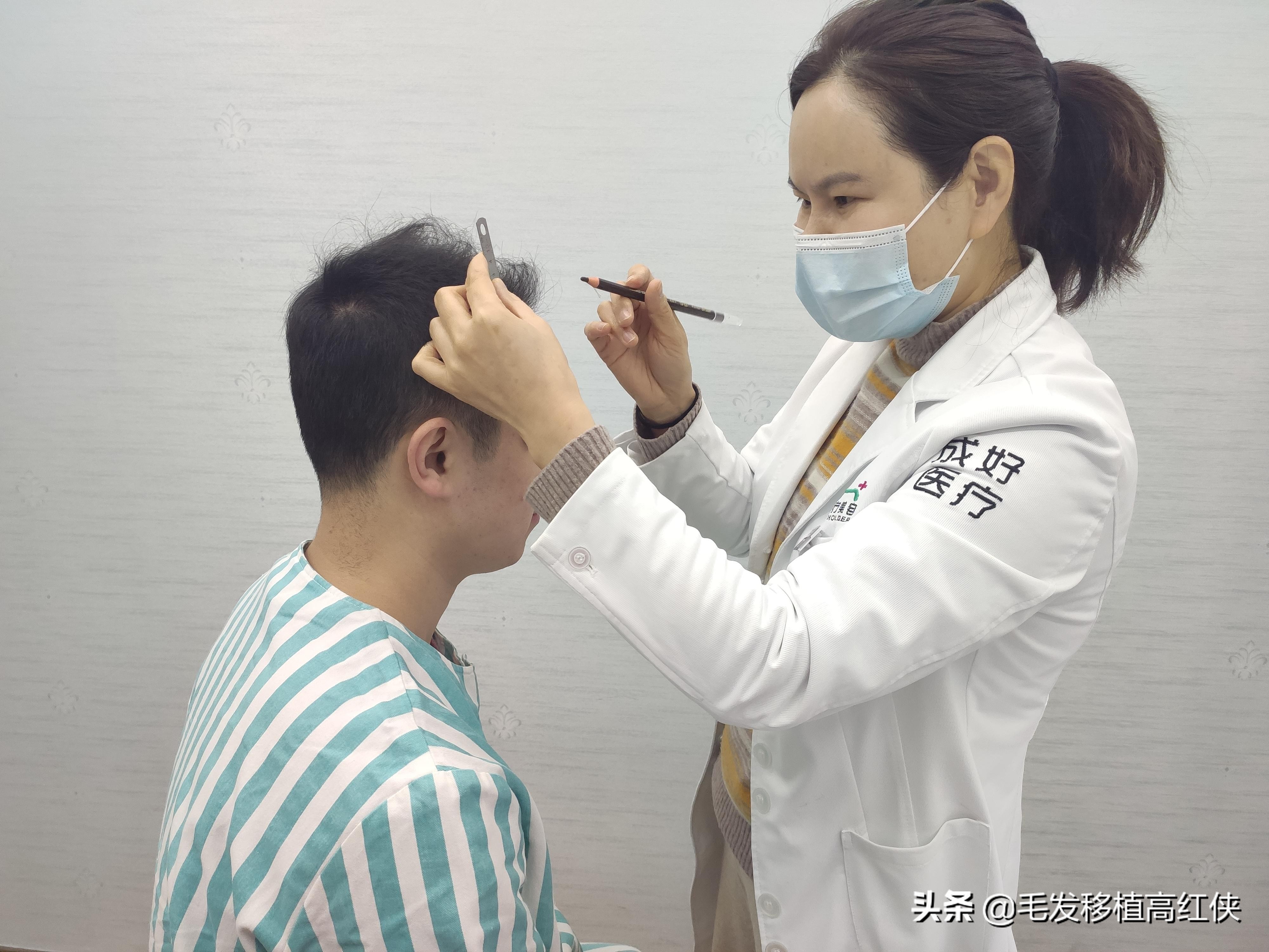 脱发到底怎么办植发竟然只需1元,植发是治疗脱发最快的办法么