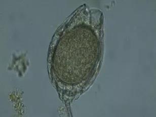 污泥镜检操作方法,污泥检测项目及标准有哪些呢