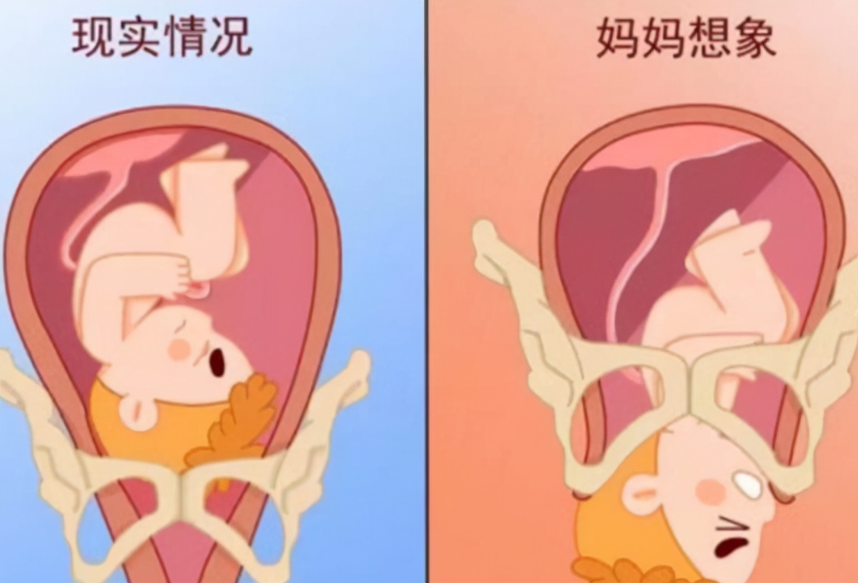 孕后期好害怕生产,孕后期担心胎儿健康