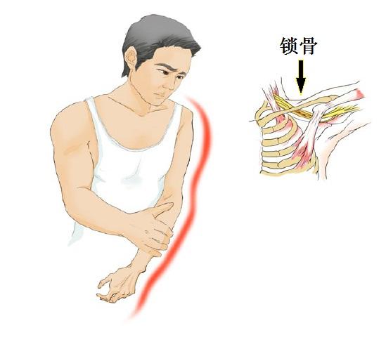 宣医科普|明明截肢了，为什么还感觉疼？