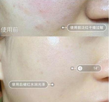 李佳琦精华小灯泡,李佳琦推荐过的精华液