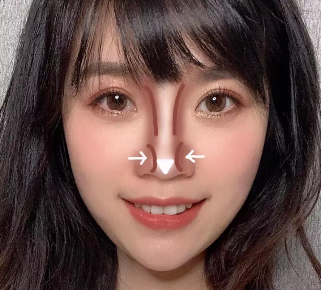 塌鼻子怎么办才显好看,塌鼻子如何让鼻根挺起来