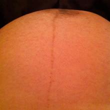 39周胎儿求救前兆有哪些,孕26周胎儿死在腹中有什么反应