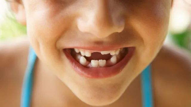 孩子换牙期不要忽略这些问题,孩子要换牙该注意什么