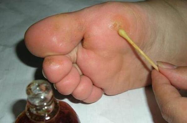 脚气脚臭用什么中药泡脚最好,白萝卜煮水泡脚多久去除脚气脚臭