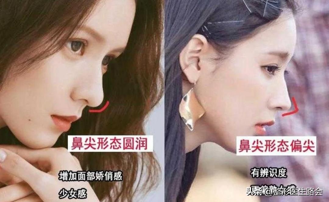 直鼻、直鼻微翘、翘鼻、微驼峰，好看的鼻子怎么选？