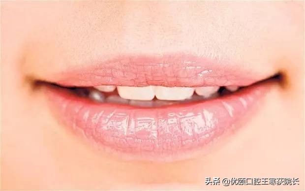 口腔溃疡怎么办教你快速摆脱烦恼,口腔溃疡别烦恼解决办法有三招