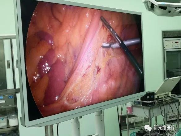 “维医护航新之所向”4K超高清腹腔镜手术直播会议顺利举行