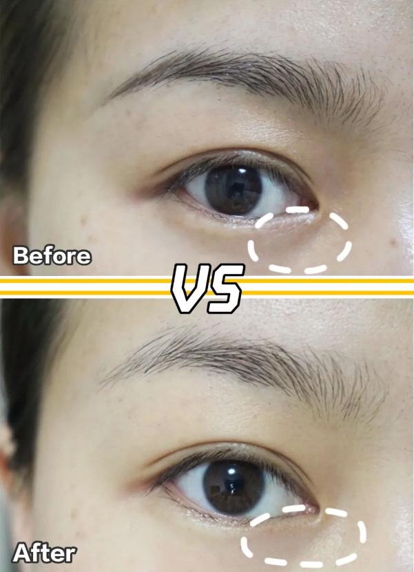 眼周皮肤脆弱的不妨做好这四点,眼周皮肤护理小攻略