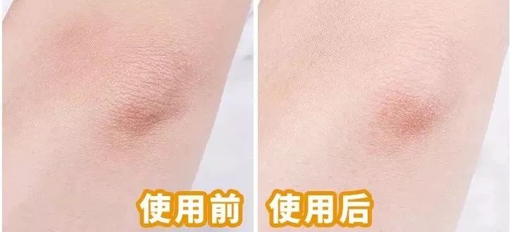 李佳琦推荐澳洲goat羊奶皂,李佳琦推荐黄黑皮克星