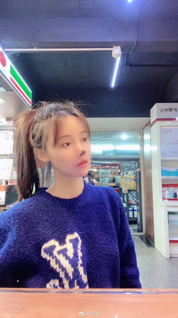 女星高溜整容,演员高溜整容失败欲轻生