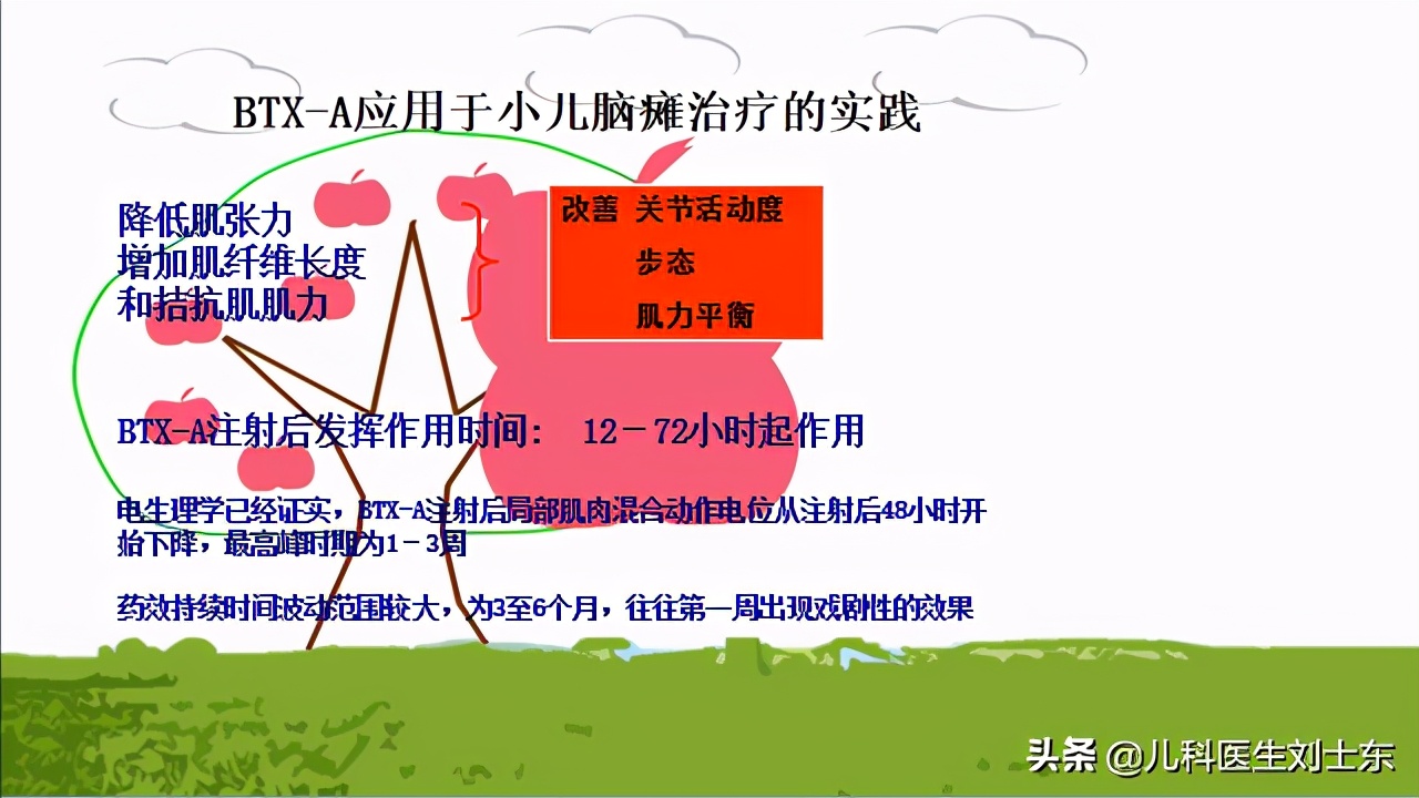 肉毒素治疗脑瘫患儿成功案例,肉毒素治疗脑瘫肌肉痉挛的效果